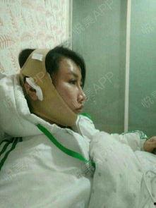 做脑手术的明星,揭秘明星勇敢接受脑手术的励志故事